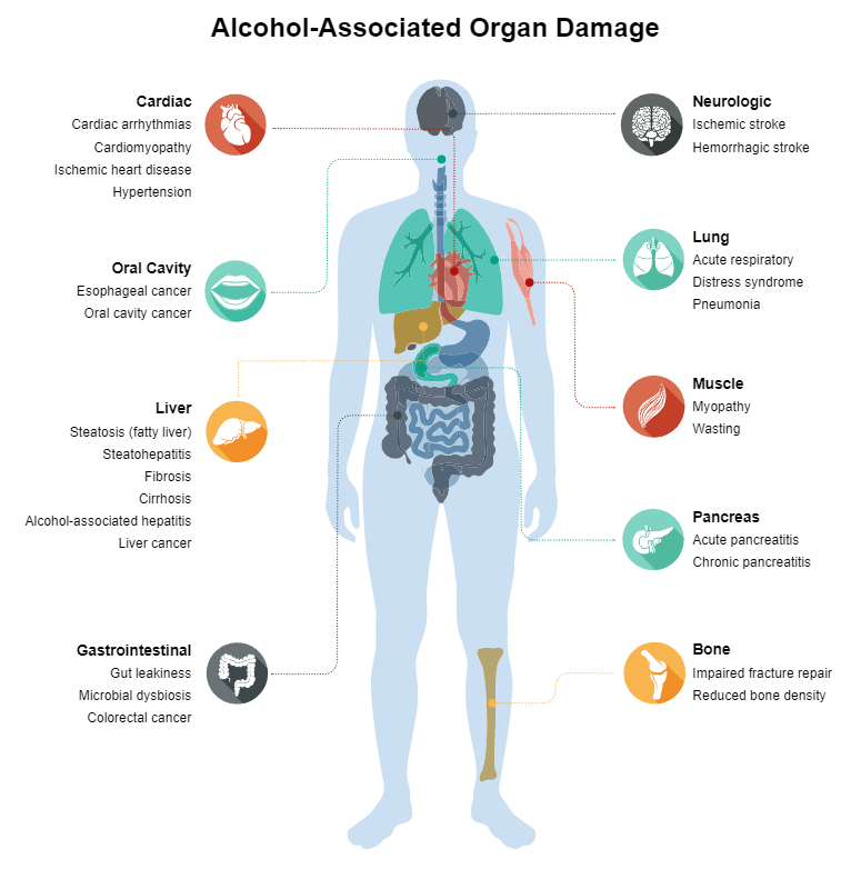 What Are the 12 Signs of Alcoholism?