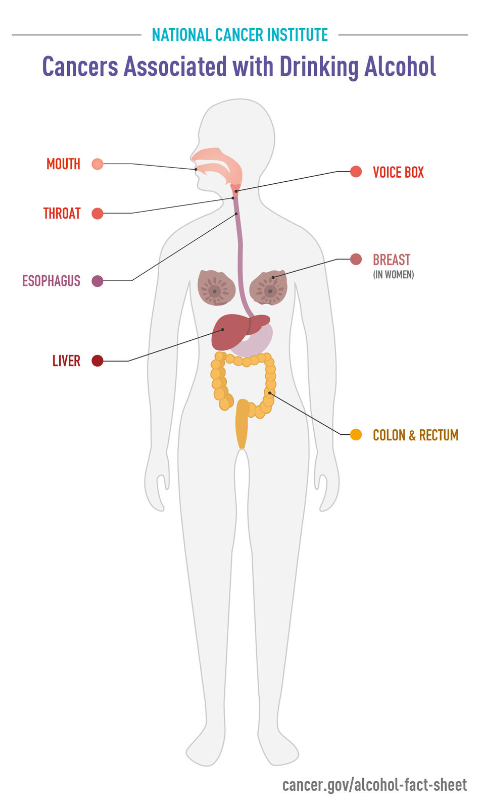 An image depicting human body and different types of cancer associated with alcohol consumption